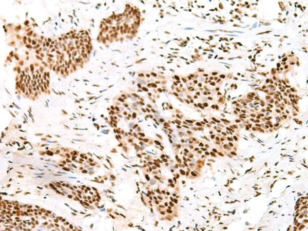 Treacle / TCOF1 Antibody