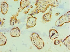 Polyclonal Rabbit anti-Human SCP2 / SCPX Antibody (aa1-322, IHC, WB)