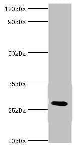 C4BPB / C4BP Beta Antibody (aa18-252)