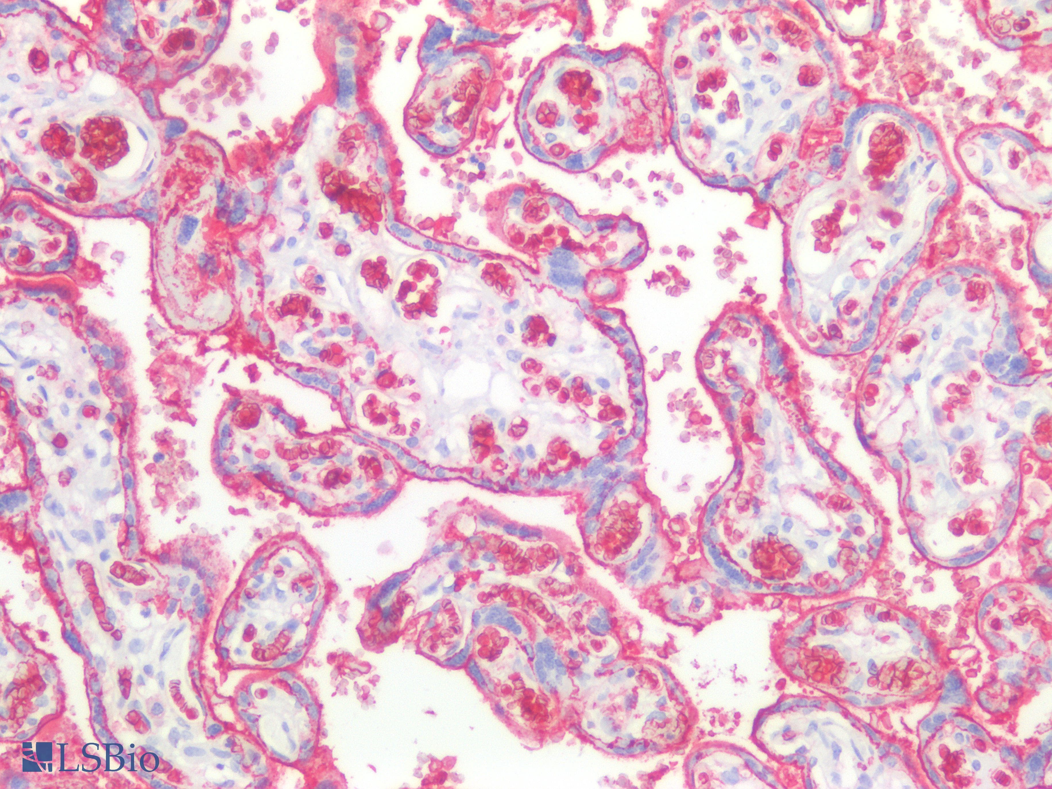 PathPlus™ SLC2A1 / GLUT-1 Antibody (Concentrated)