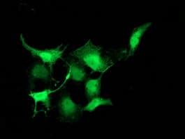 PNMT Antibody (clone OTI2E3)