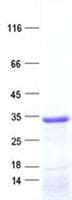 Human ASB11 Protein (Recombinant His, N-Terminal)