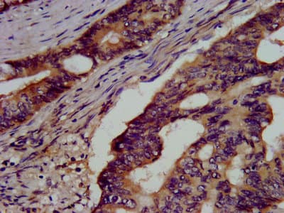 Polyclonal Rabbit anti-Human GSS / Glutathione Synthetase Antibody (IHC, WB)