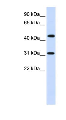 Polyclonal Rabbit anti-Human ZNF684 Antibody (aa72-121, WB)