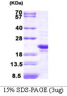 Human PRDX2 / Peroxiredoxin 2 Protein (Recombinant)