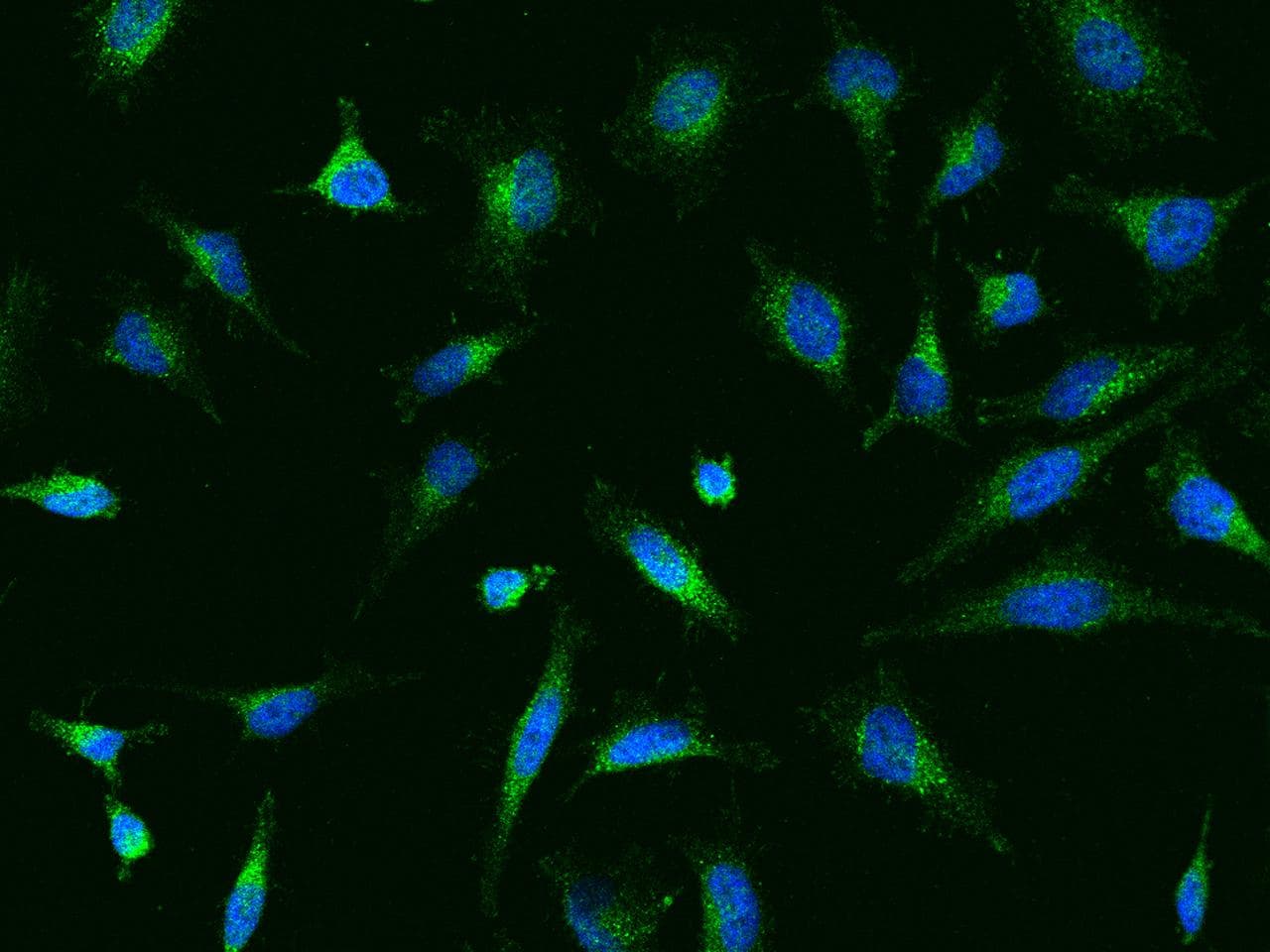 Polyclonal Rabbit anti-Human ADAM17 / TACE Antibody (IF, WB)