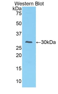 IRAK2 / IRAK-2 Antibody (aa211-458)