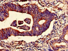 TRIM4 / RNF87 Antibody