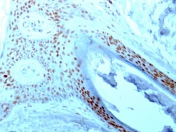 NCL / Nucleolin Antibody (clone 364-5, Ready-to-Use)