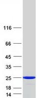 Human HPCAL1 / Hippocalcin-Like 1 Protein (Recombinant Myc-DDK (Flag))