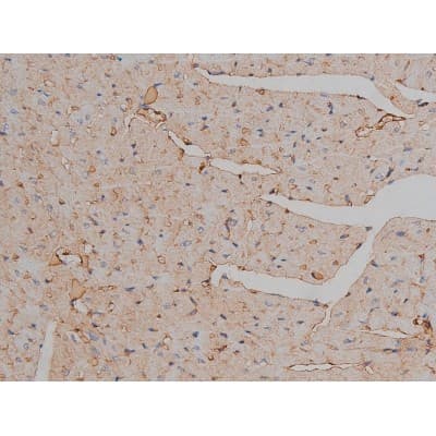 MAPT / Tau Antibody (phospho-Ser404)
