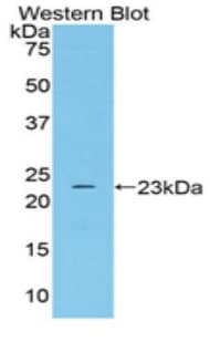 TLN1 / Talin 1 Antibody (aa975-1181)