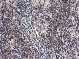 GBA3 / CBG Antibody (clone OTI1F1)