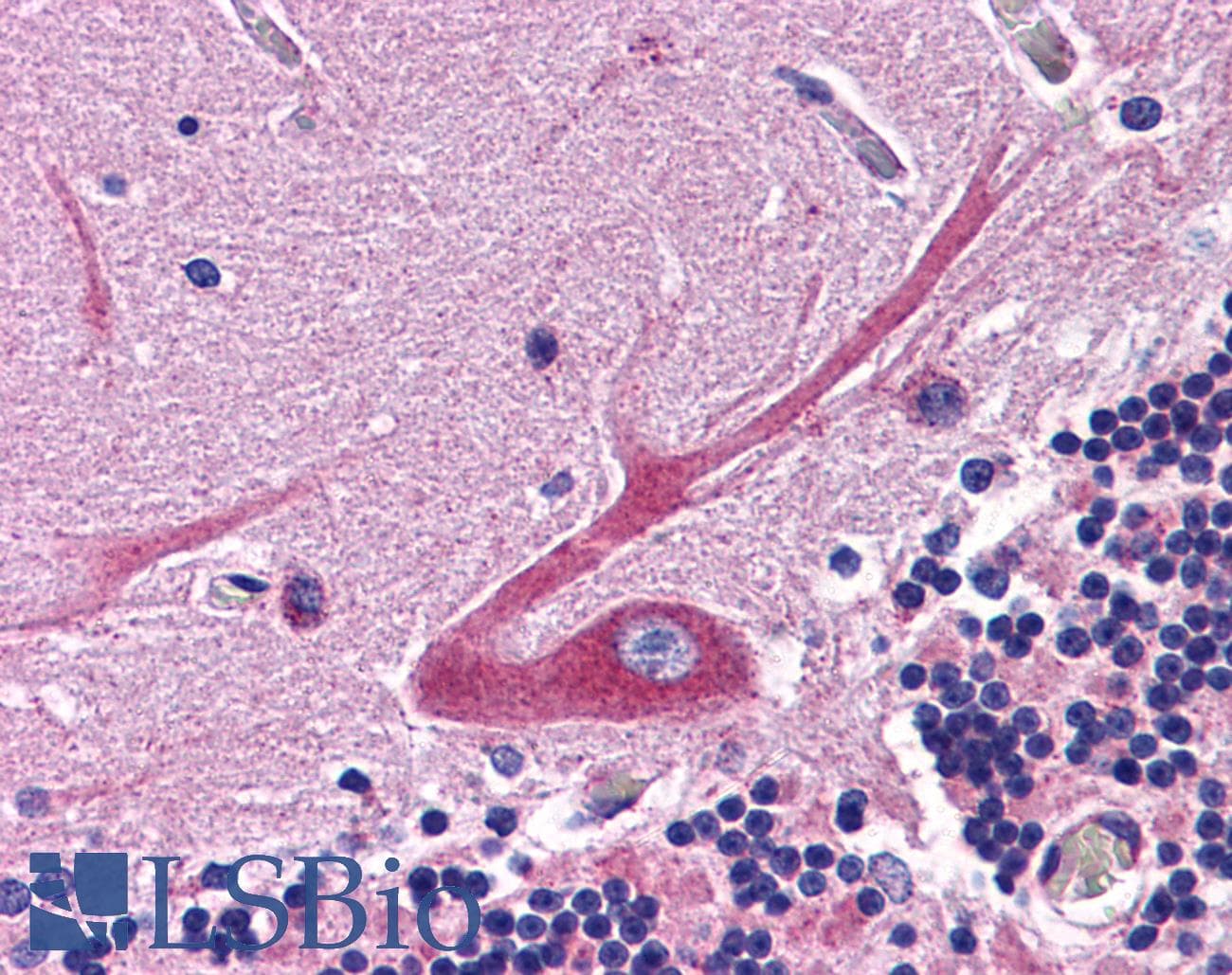 IHC-plus™ NDUFB9 Antibody