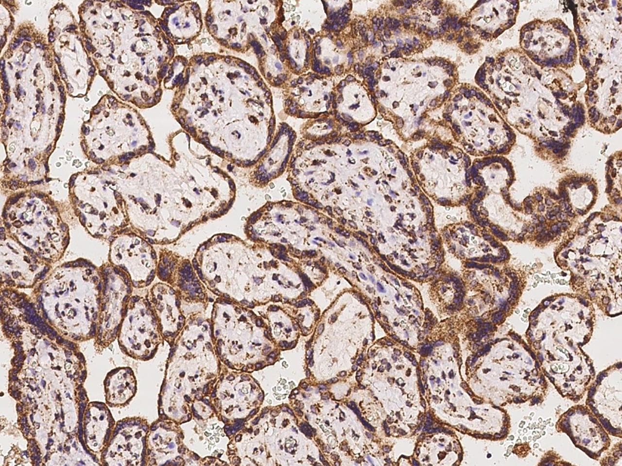 Polyclonal Rabbit anti-Human EFTU / TUFM Antibody (IHC, IF, WB)