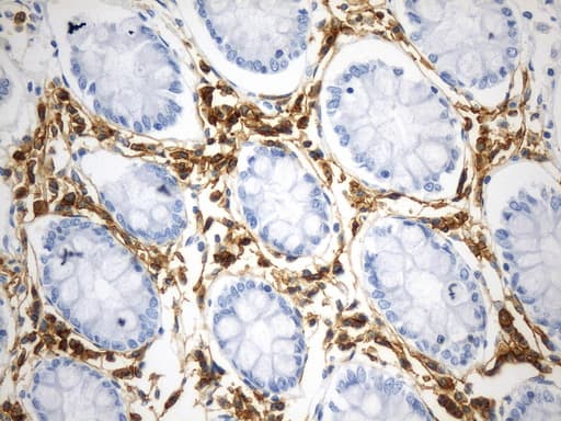 CD38 Antibody (aa43-300, clone UMAB263, Carrier-free)