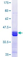 Human KDM2B / FBXL10 Protein (Recombinant GST, N-terminus)