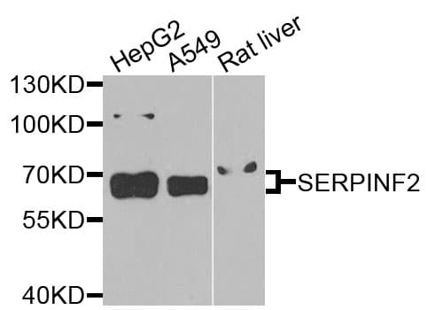 Polyclonal Rabbit anti-Human SERPINF2 / Alpha-2-Antiplasmin Antibody (WB)