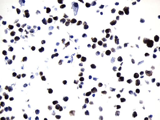 Monoclonal Mouse anti-Human VIL1 / Villin Antibody (clone UMAB230, Carrier-free, aa1-188, IHC)