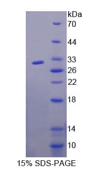 Human FBXW7 / FBW7 Protein (Recombinant His-T7)