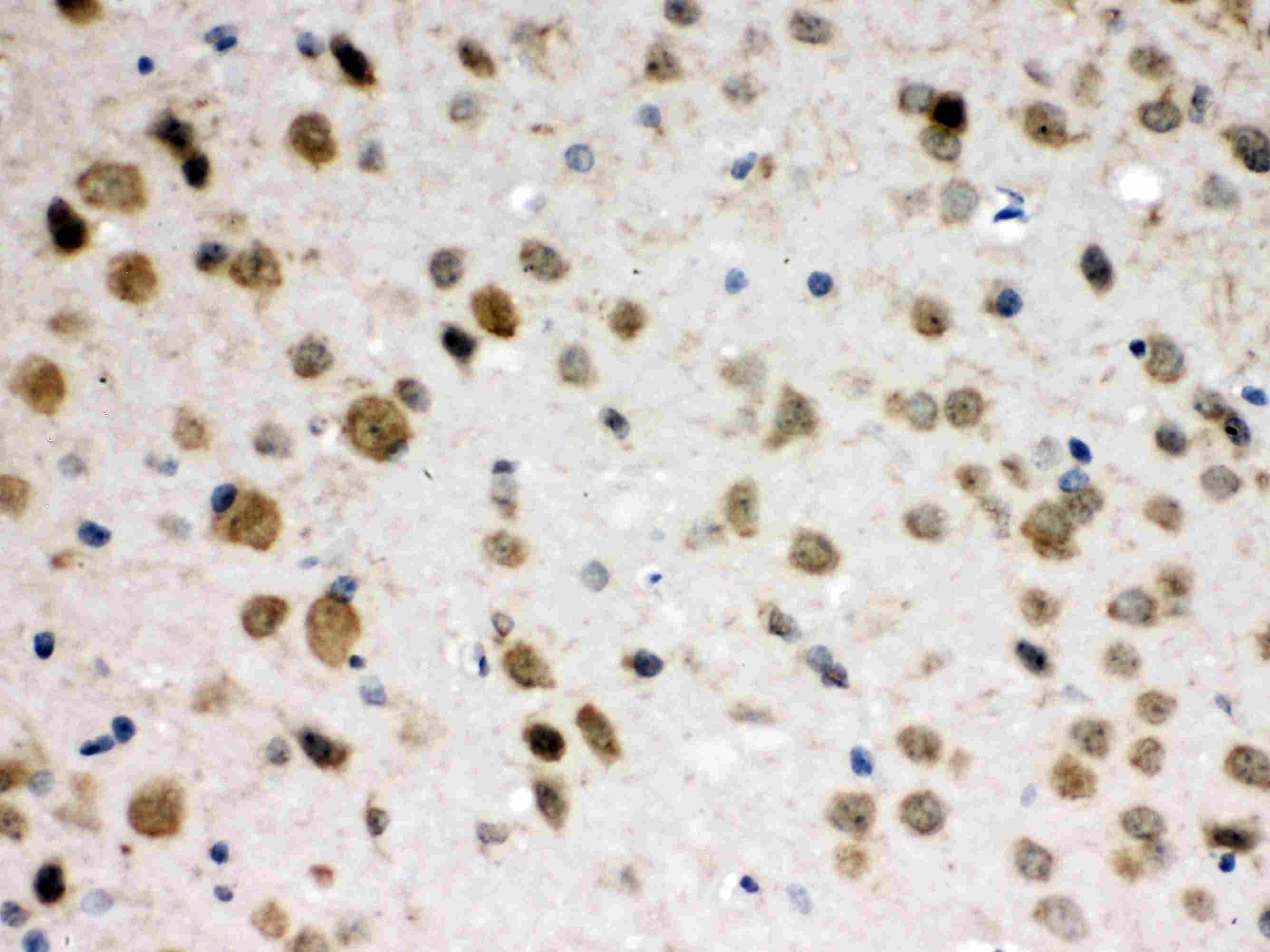 ABR Antibody