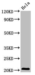 Polyclonal Rabbit anti-Human ARL1 Antibody (IHC, IF)