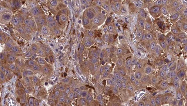 GPR148 Antibody
