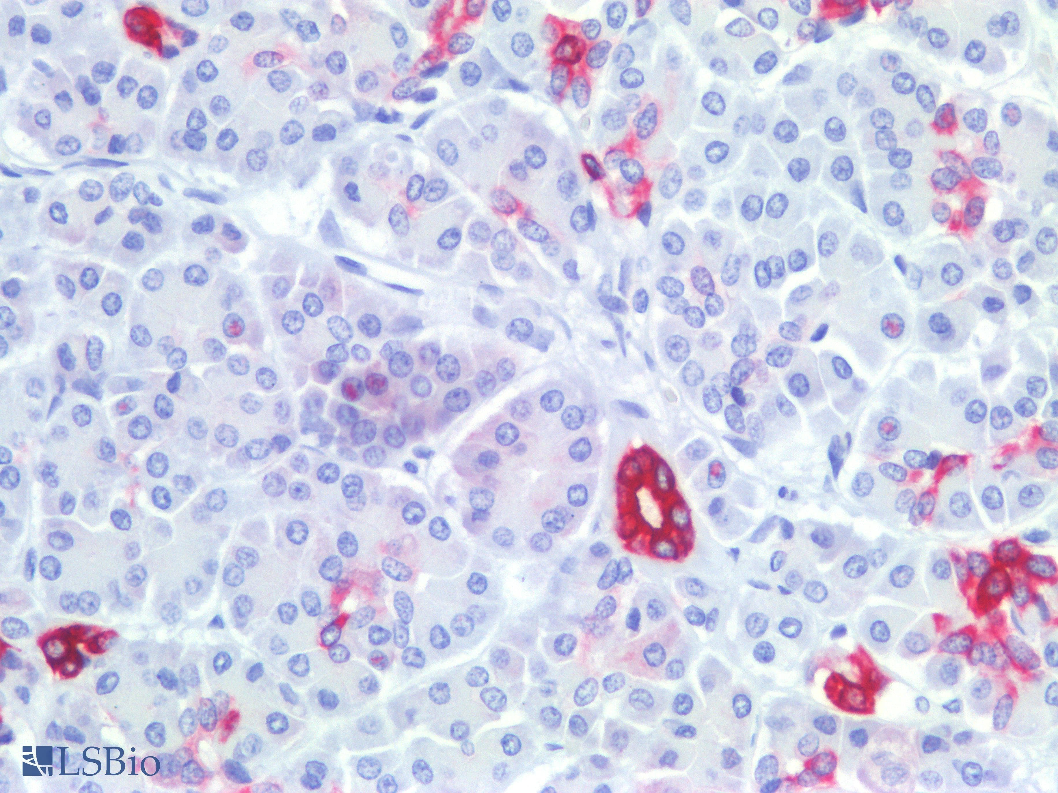 PathPlus™ Monoclonal Mouse anti-Human KRT7 / CK7 / Cytokeratin 7 Antibody (clone OVTL12/30, IHC, WB)