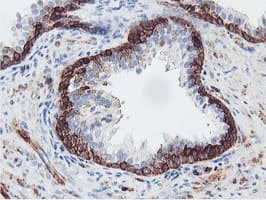 PFKP Antibody (clone OTI5F7)