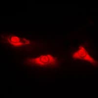 PARK7 / DJ-1 Antibody (Internal)