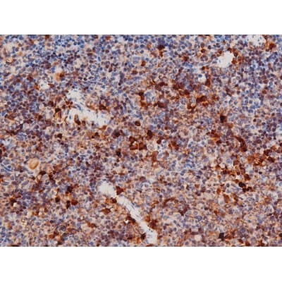 STAT3 Antibody (phospho-Ser727)