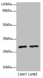 Polyclonal Rabbit anti-Human APIP Antibody (IHC, WB)