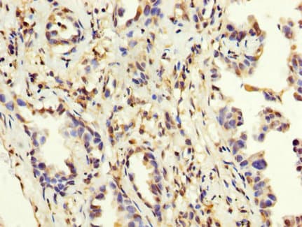 MAGEA3 Antibody