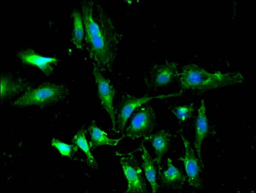 Polyclonal Rabbit anti-Human WTAP Antibody (IHC, IF, WB)