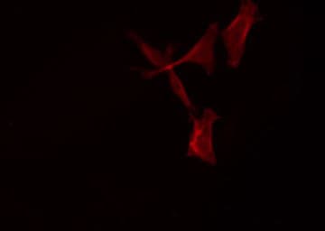 Polyclonal Rabbit anti-Human SCTR / SR / Secretin Receptor Antibody (IF, WB)