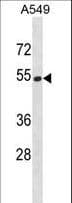 HERPUD2 Antibody (aa305-334)