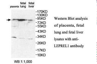 P3H2 / LEPREL1 Antibody (aa233-399)