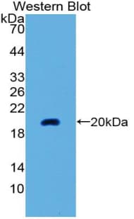 NMU / Neuromedin U Antibody (aa38-174, PE)