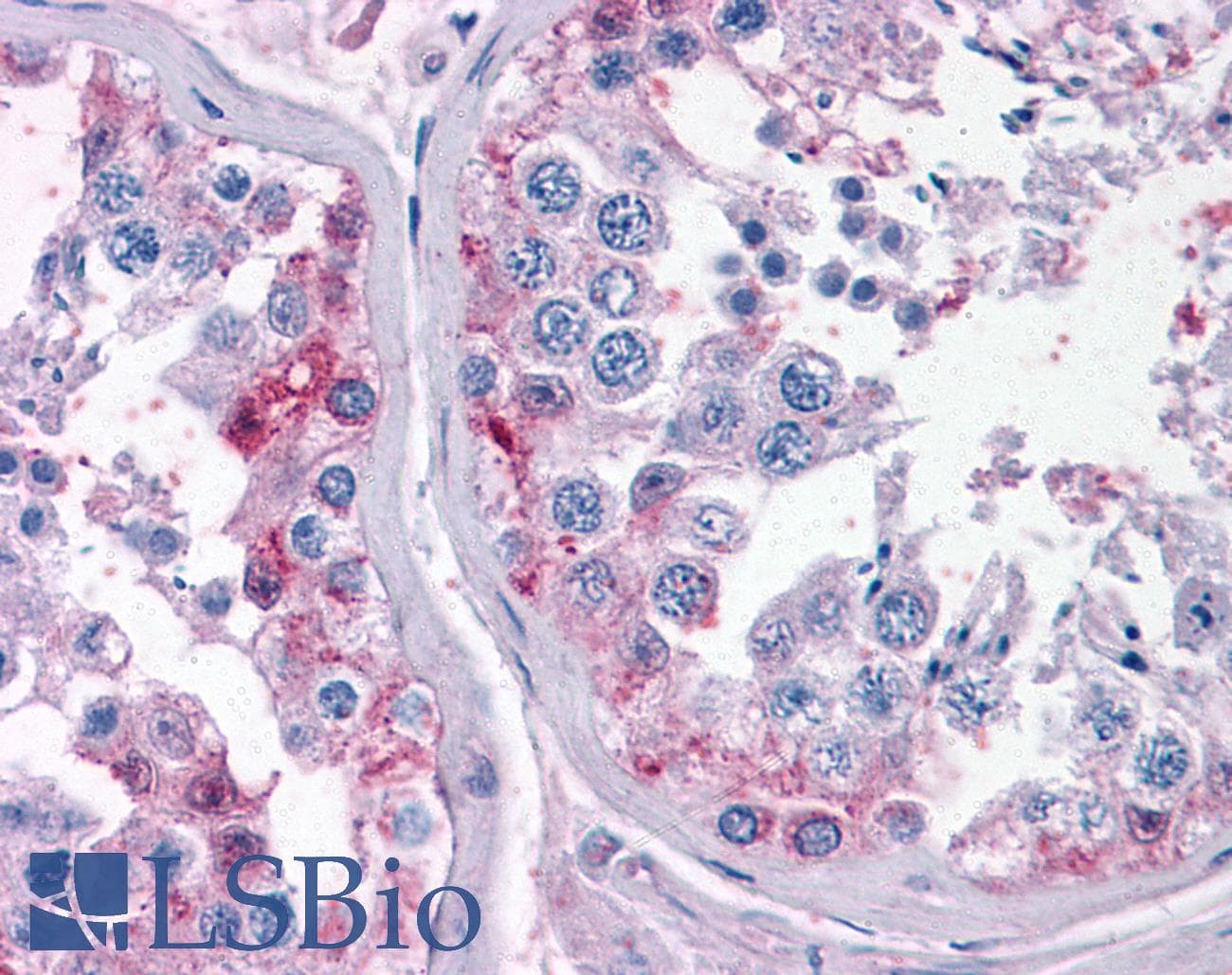 IHC-plus™ CYP26B1 Antibody (aa418-430)