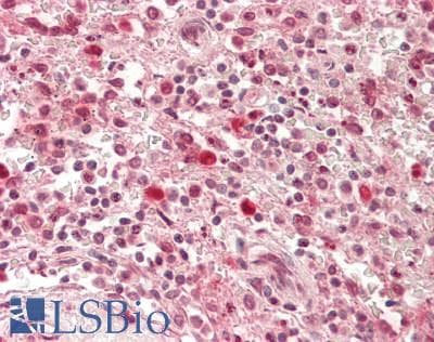 IHC-plus™ Monoclonal Mouse anti-Human ARRB1 / Beta Arrestin 1 Antibody (IHC, WB)