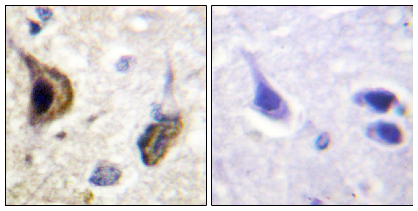 Polyclonal Rabbit anti-Mouse KCNJ16 / Kir5.1 Antibody (phospho-Ser417, IHC, IF, WB)