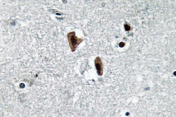 LMNB1 / Lamin B1 Antibody (Leu75)
