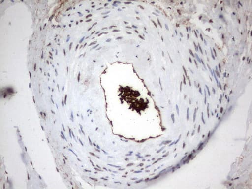 MLF1 Antibody (clone UMAB138)