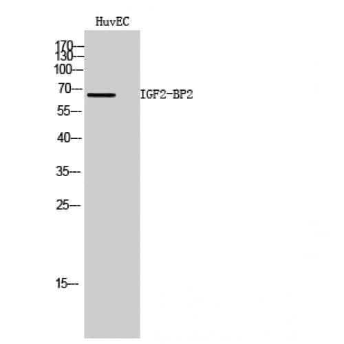 Polyclonal Rabbit anti-Human IGF2BP2 Antibody (110-190 aa, Internal, WB)