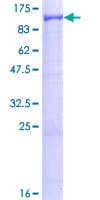 Human VPS41 Protein (Recombinant GST)