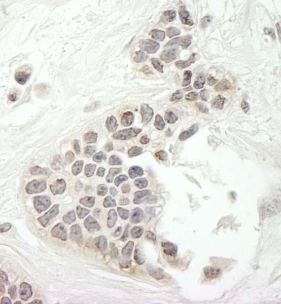 KIF14 Antibody (aa1600-C-term)