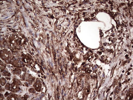 PKM2 Antibody (clone 1G10)