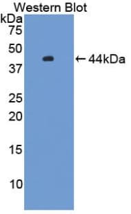 HFE2 / Hemojuvelin Antibody (aa29-401)
