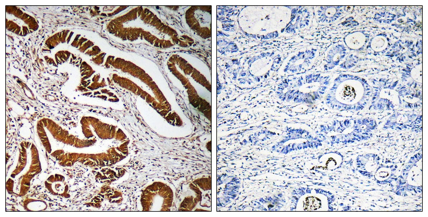 MEN1 / Menin Antibody