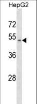 ZDHHC1 Antibody (aa14-43)